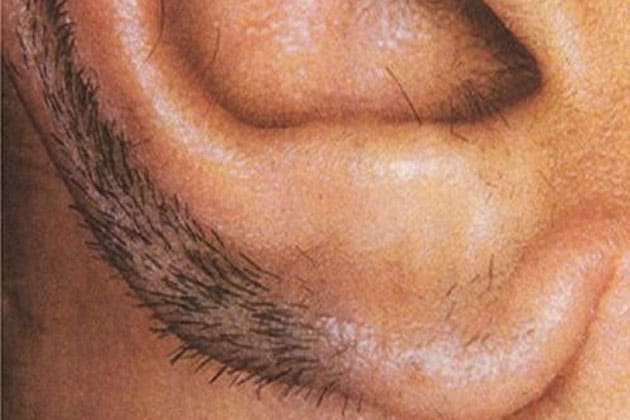 Know some interesting facts about those who have hair in their ears.