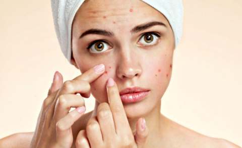 Learn how to remove pimples and black spots from the face here.