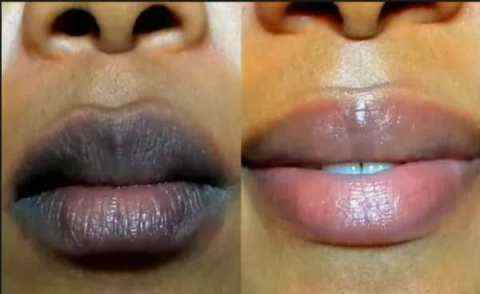 Know how to make black lips pink