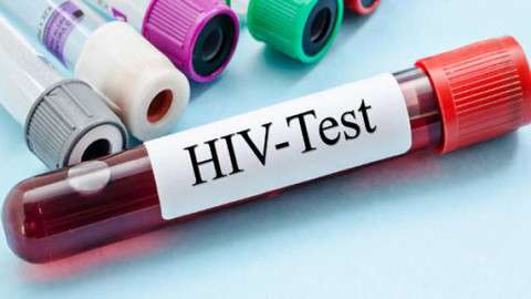 The second man in the world became fully aware of HIV, know about it