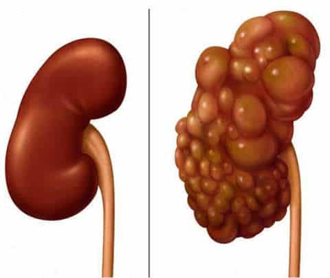 These 3 things spoil the kidney completely