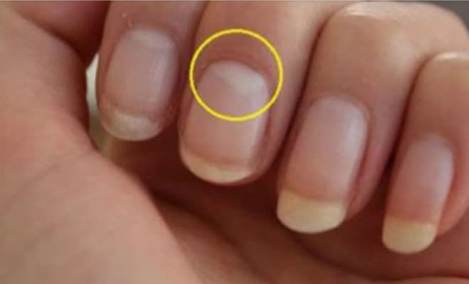 Know why it is half moon in nails